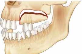 奇克牙槽骨骨折多颗牙齿脱落，媒体预计他近期无法进食和讲话